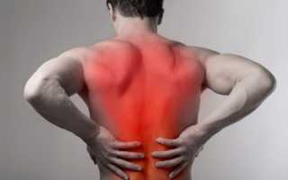 Симптомы болей мышц спины