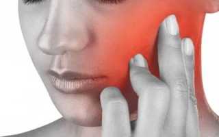 Болит голова отдает в челюсть шею