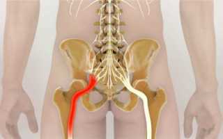 Болит нижняя часть спины лечение