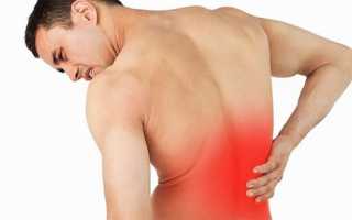 Болит спина потянул мышцу