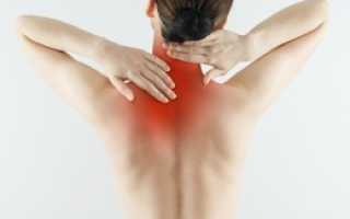 Болит спина вверху около шеи