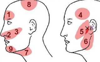 Когда болит весок на голове