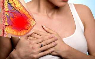 Болит грудь от кисты и спина