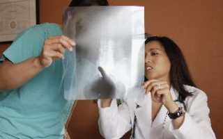 Диагностика болей в спине и пояснице у женщин