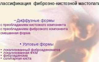 При мастопатии может болеть голова