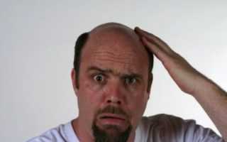 Почему болит кожа головы на макушке и выпадают волосы