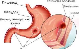 Что значит когда сильно болит живот и спина