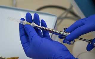 Удалили корни болит голова