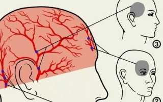 Почему сильно болит голова и глаз