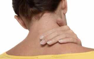 Болит затылок и кружится голова болит спина