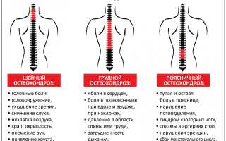 Болит вся спина ноет