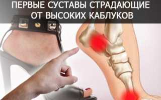 От хождения на каблуках болит спина