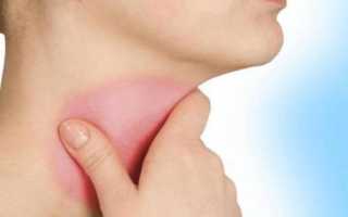 Почему все болит горло голова