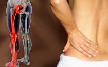 От чего может болеть нога боль отдает в спину и чем лечить