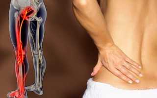 От чего может болеть нога боль отдает в спину и чем лечить