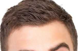 Почему болит голова правая сторона бровь