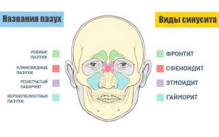 Заложен нос болит голова температуры