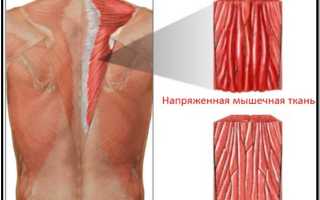 От сквозняков болит спина