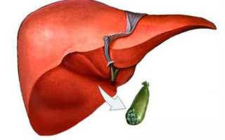 После удаления желчного пузыря болит спина что это