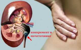 Болит левая часть спины причины