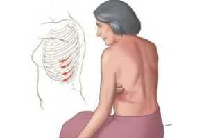 Болит в правой области ребер спины