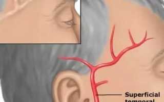 Болит голова правый висок и давит