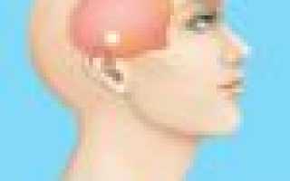 Сильно болит голова и висок