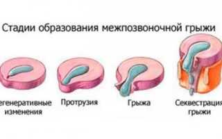 Очень сильно болит спина в области шеи