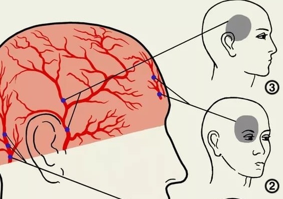 Почему сильно болит голова и глаз