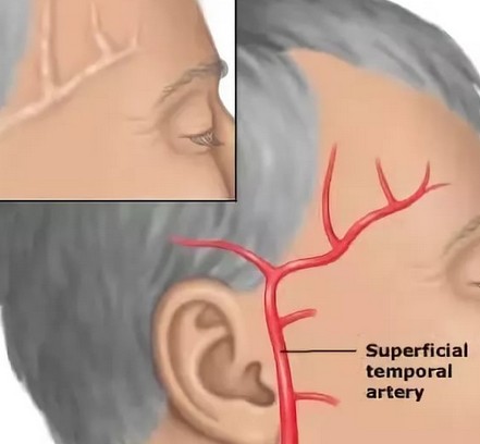 болит голова правый висок и давит