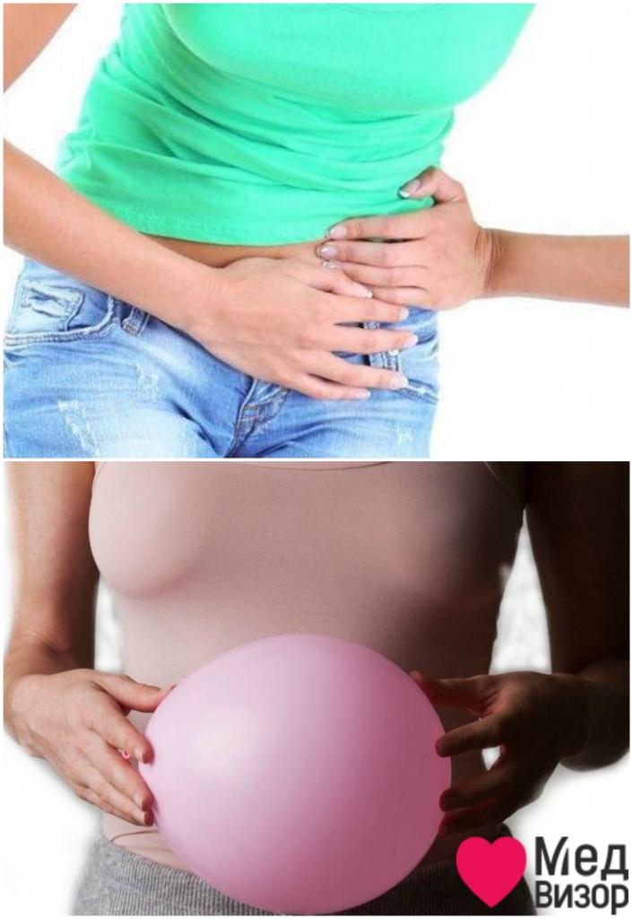 Дивертикулез симптомы: боли в нижней левой части живота, могут отдавать в спину; вздутие живота Тошнота понос болит живот спина