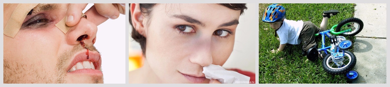 Стукнулась головой болит нос