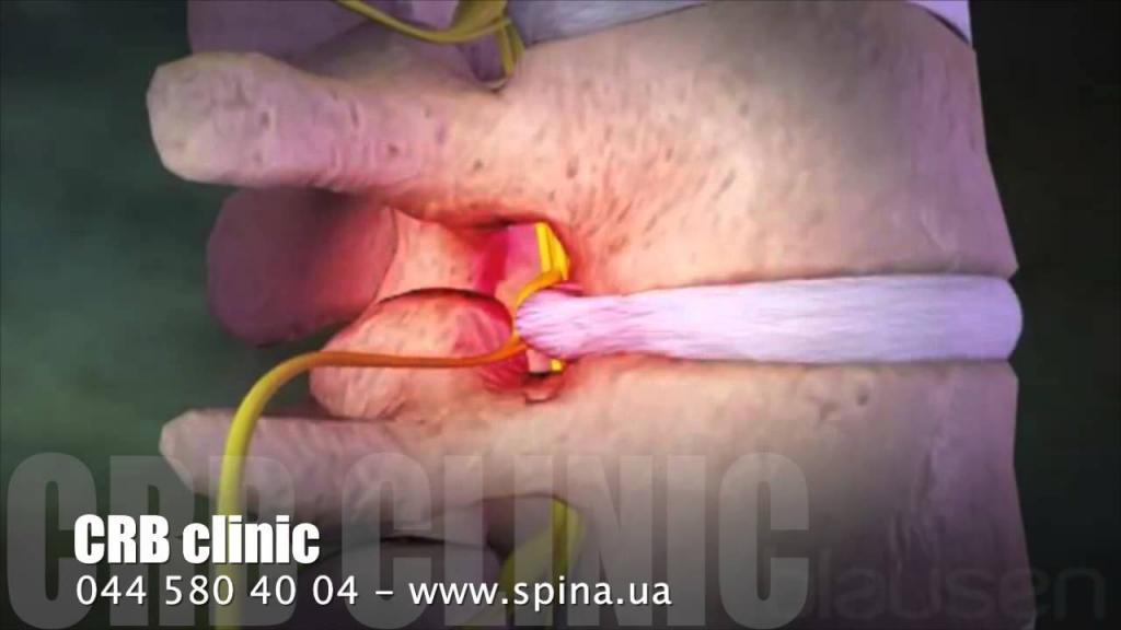 Почему все время болит спина внизу