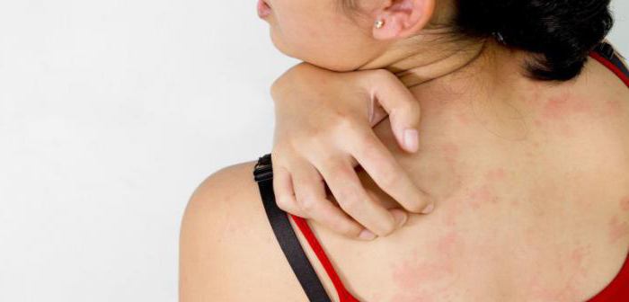 Почему чешется спина