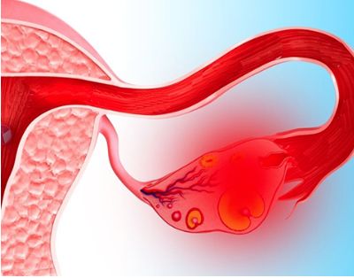 когда после месячных болит спина