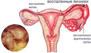 когда после месячных болит спина
