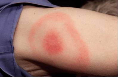 что делать если очень сильно болит голова и слабость