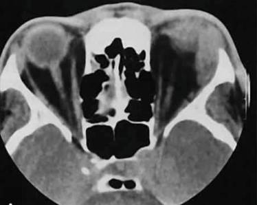 Болит спина может быть температура