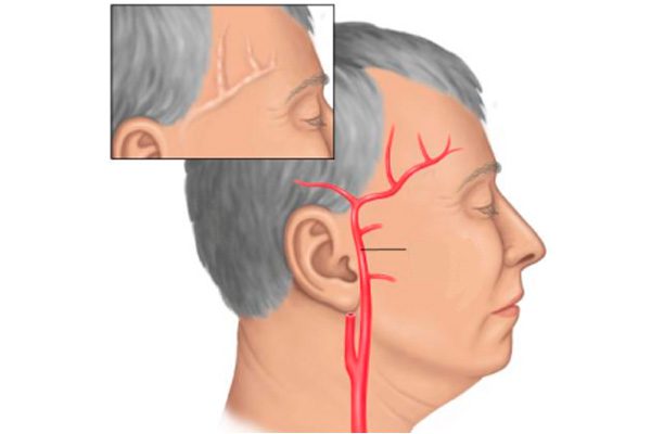 Голова болит таблетки ни у кого нет
