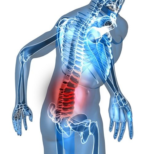 Боль в пояснице Болит поясница: причины у женщин