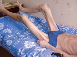 У подростка болит спина к какому врачу идти