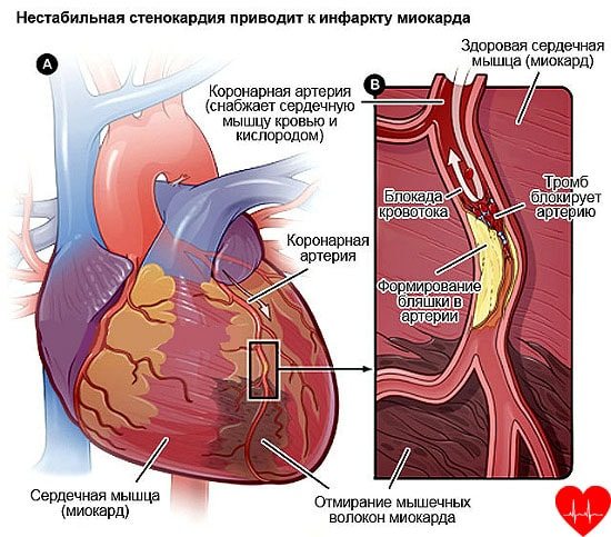 Сильно болит спина справа в середине