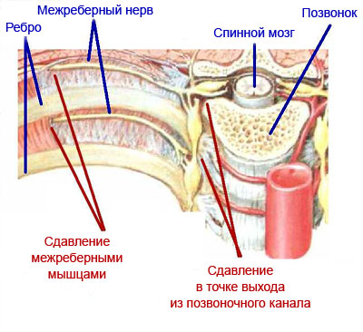 Болит в правой области ребер спины