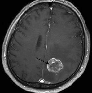 что делать если очень сильно болит голова и слабость