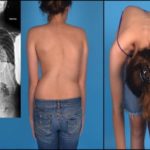 Болит спина и отдает в грудную клетку что это такое