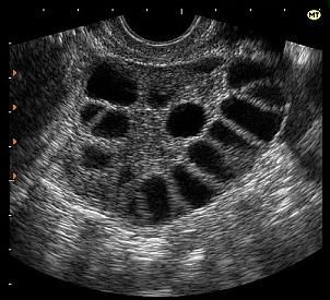 когда после месячных болит спина