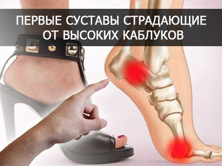 Высокий каблук и суставы 