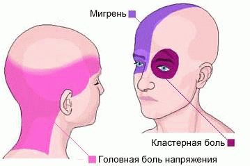 Голова болит таблетки ни у кого нет